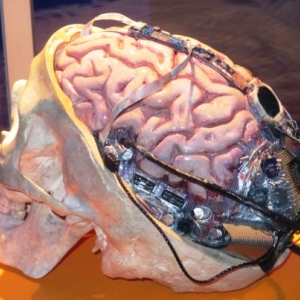 Notre boite cranienne